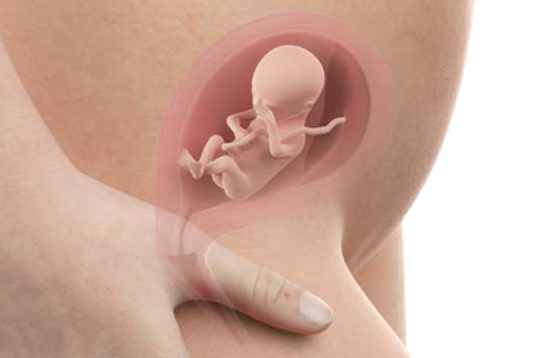 17 weeks pregnant