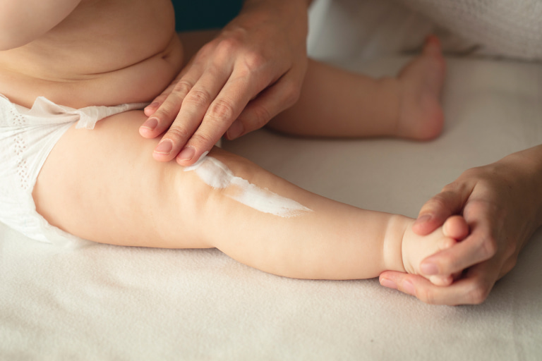 F0537  Rash Baby Treatment