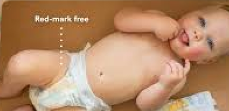 Baby resting comfortably in a Huggies diaper without a skin rash 
